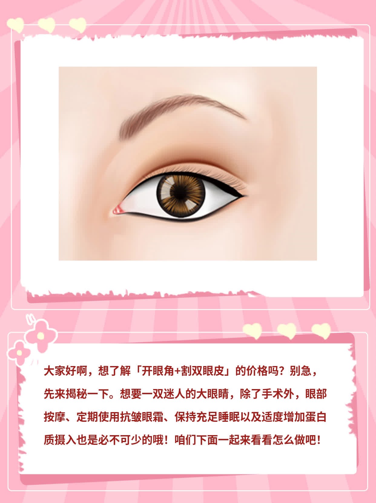 「开眼角+割双眼皮」价格揭秘：一起做双目迷人！