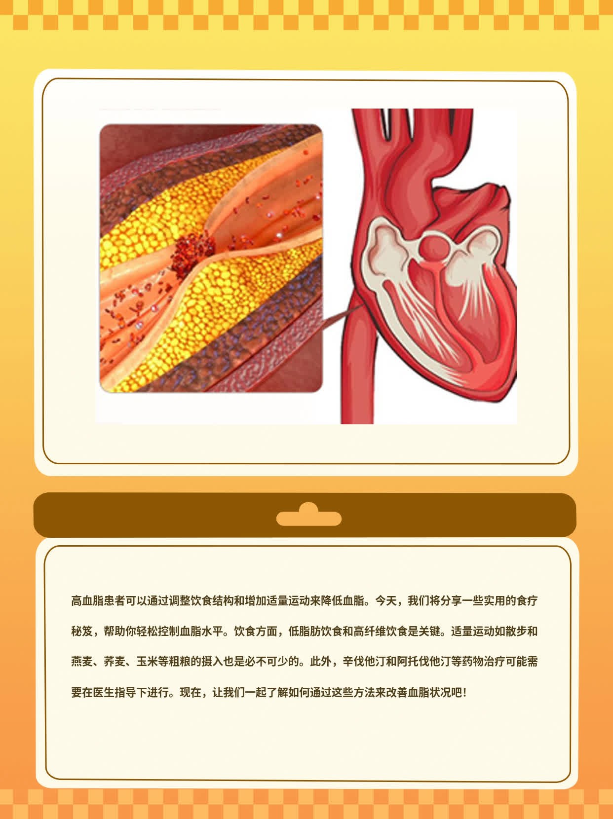 降脂饮食指南：高血脂患者的食疗秘笈