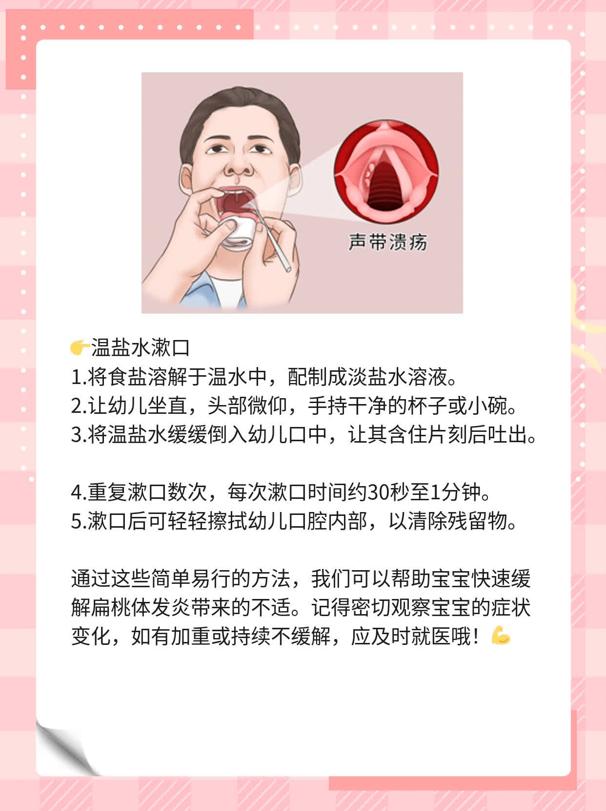 幼儿扁桃体发炎快速止痛药物推荐