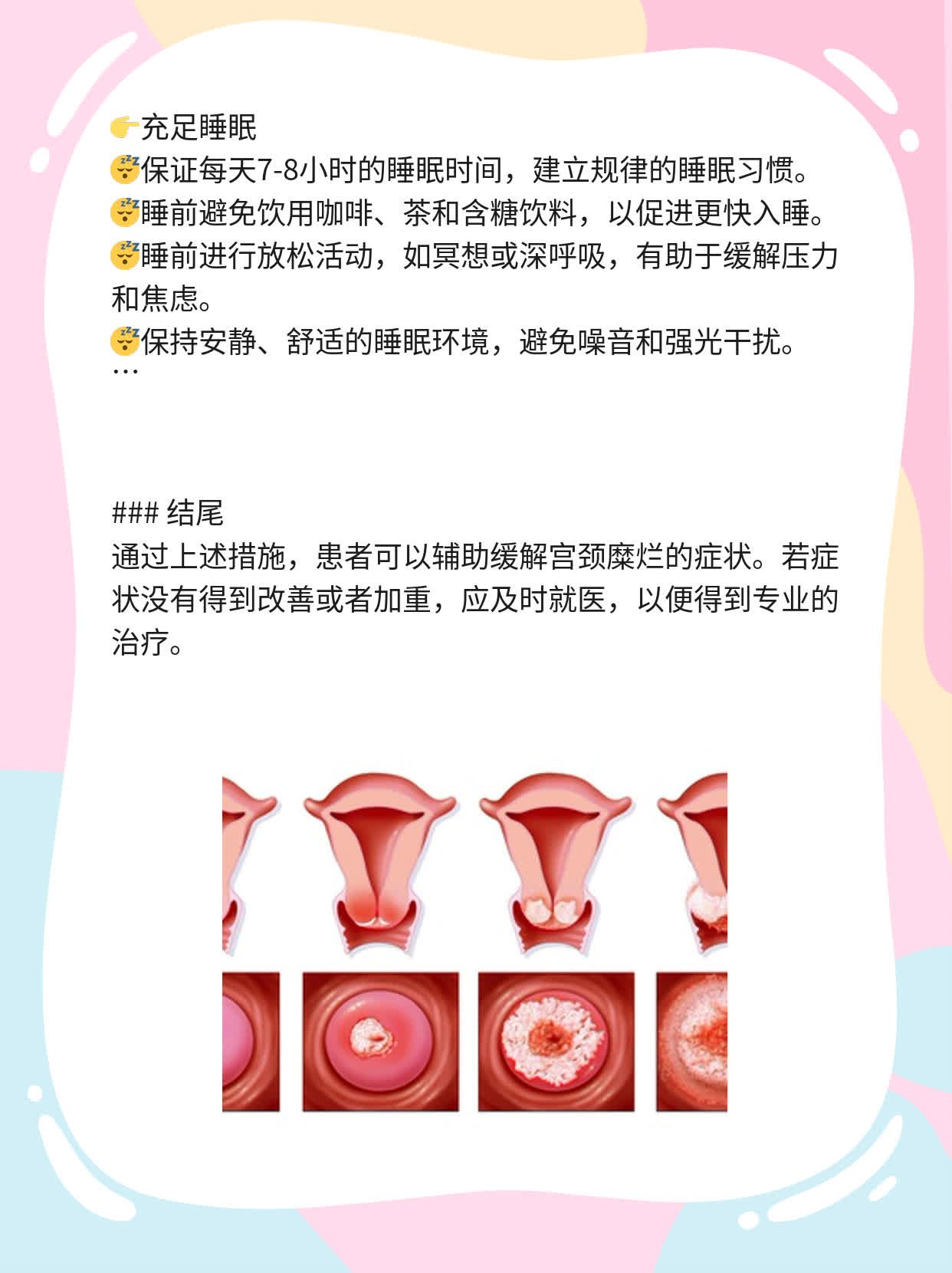 宫颈糜烂患者的饮食宜忌