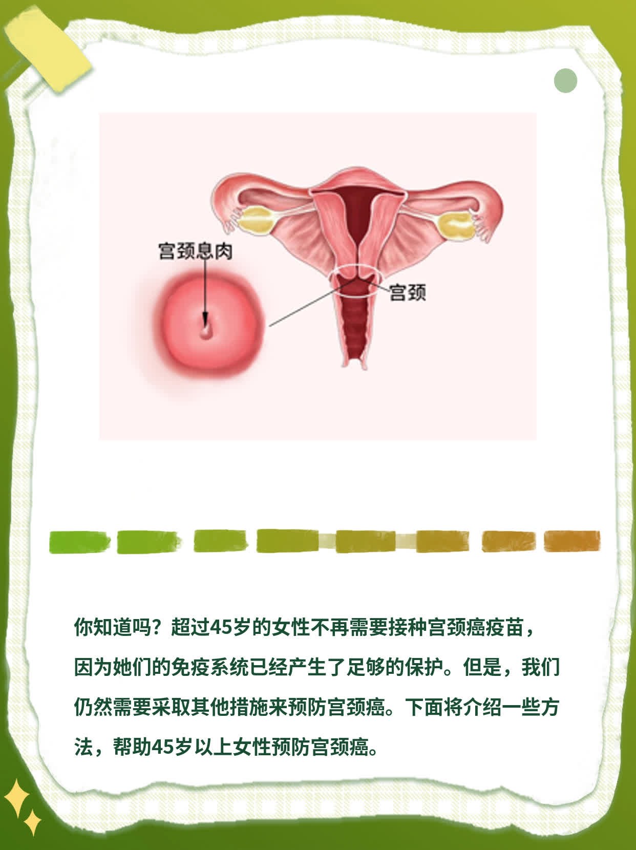 年龄限制？45岁以上女性如何预防宫颈癌？