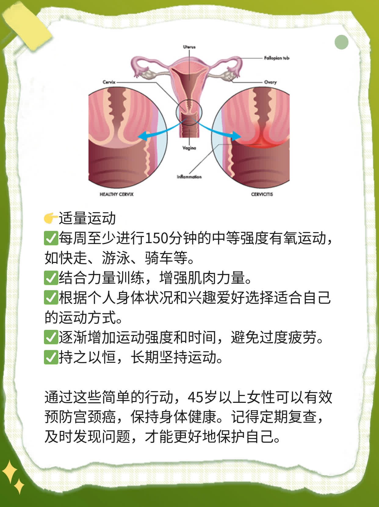 年龄限制？45岁以上女性如何预防宫颈癌？