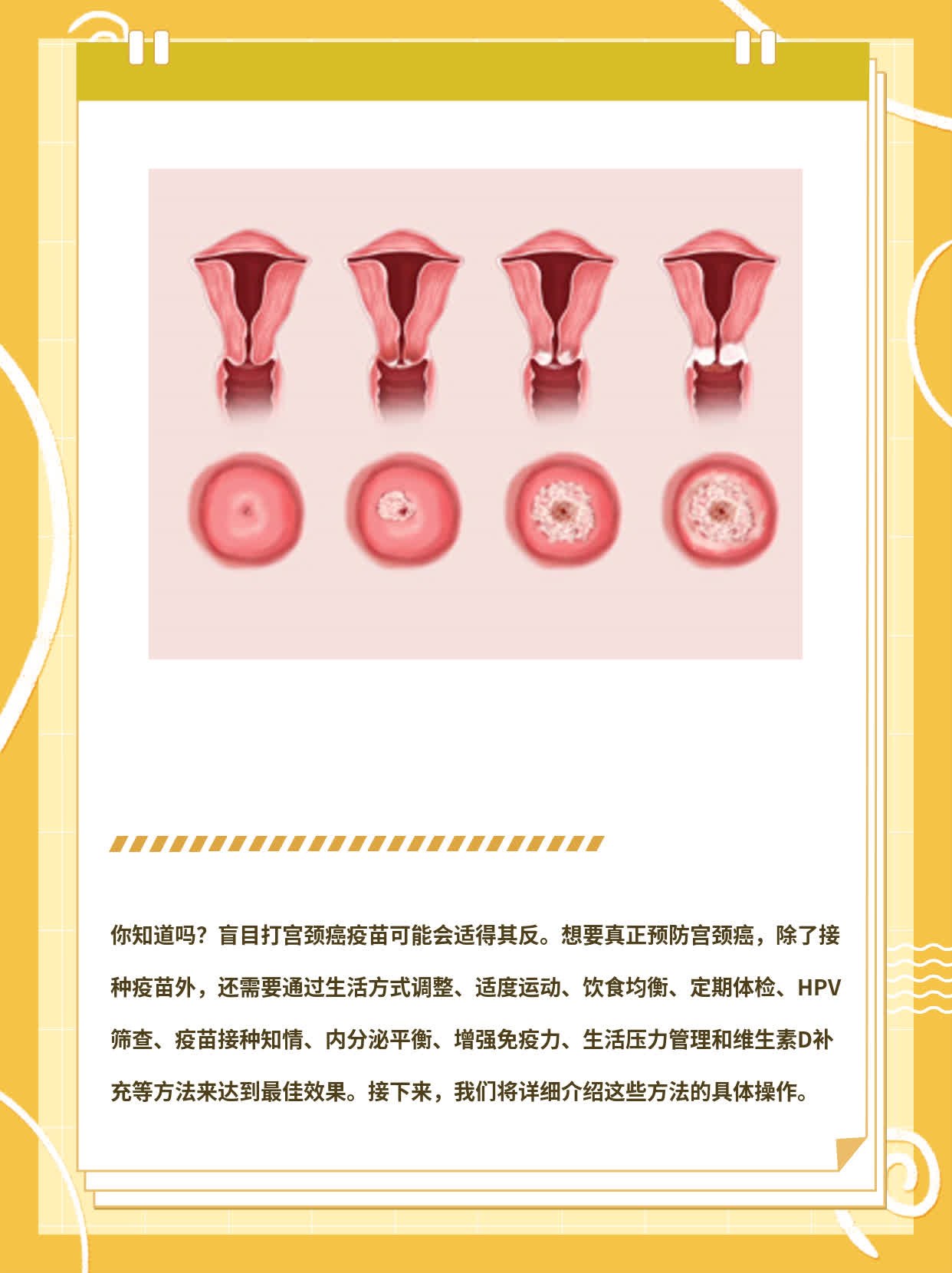 「经验分享」为什么劝你不要盲目打宫颈癌疫苗？