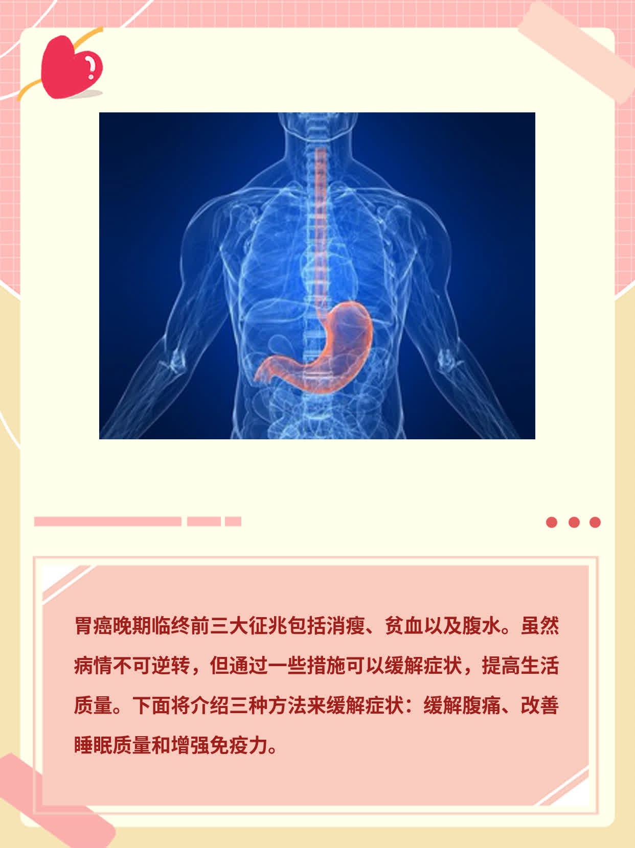 探秘：胃癌晚期临终前三大征兆
