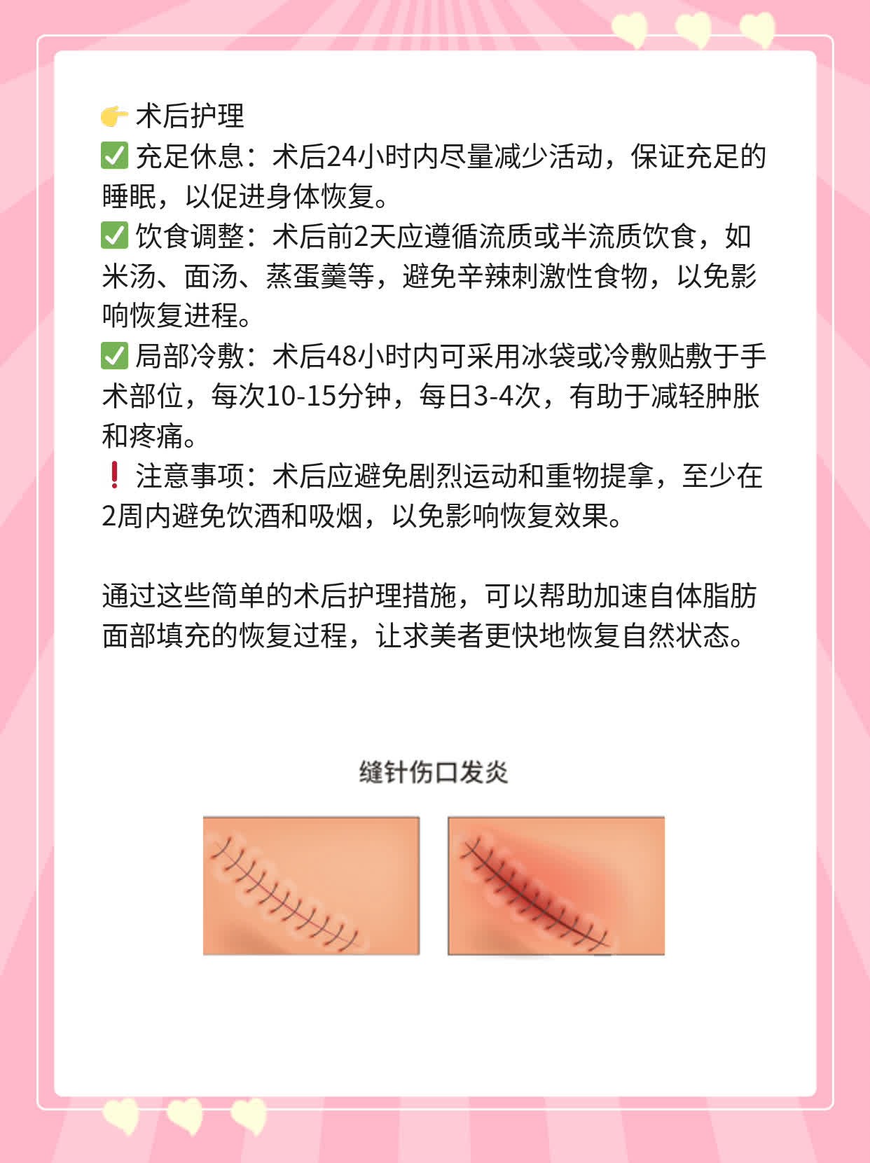 自体脂肪面部填充恢复期探秘