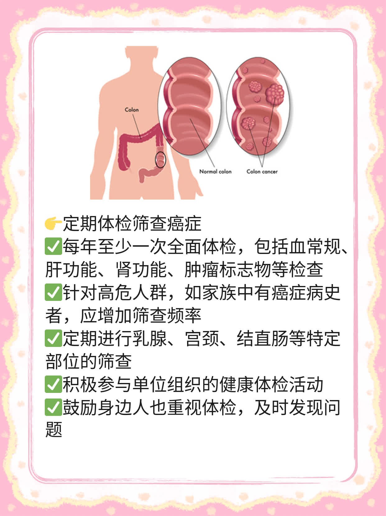 「致癌物分级」：1级比2级更厉害！致癌物分类你懂吗？