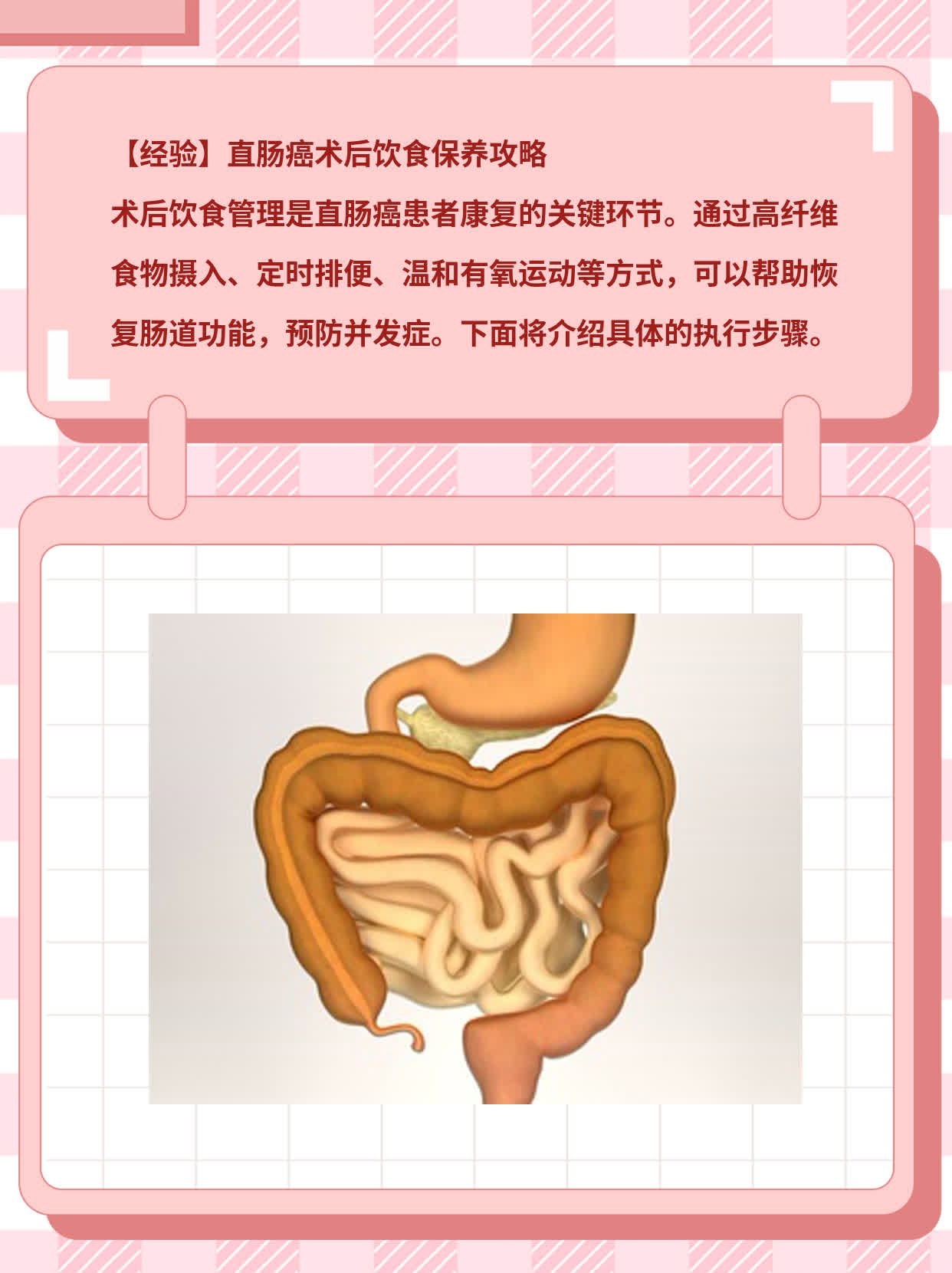 【经验】直肠癌术后饮食保养攻略