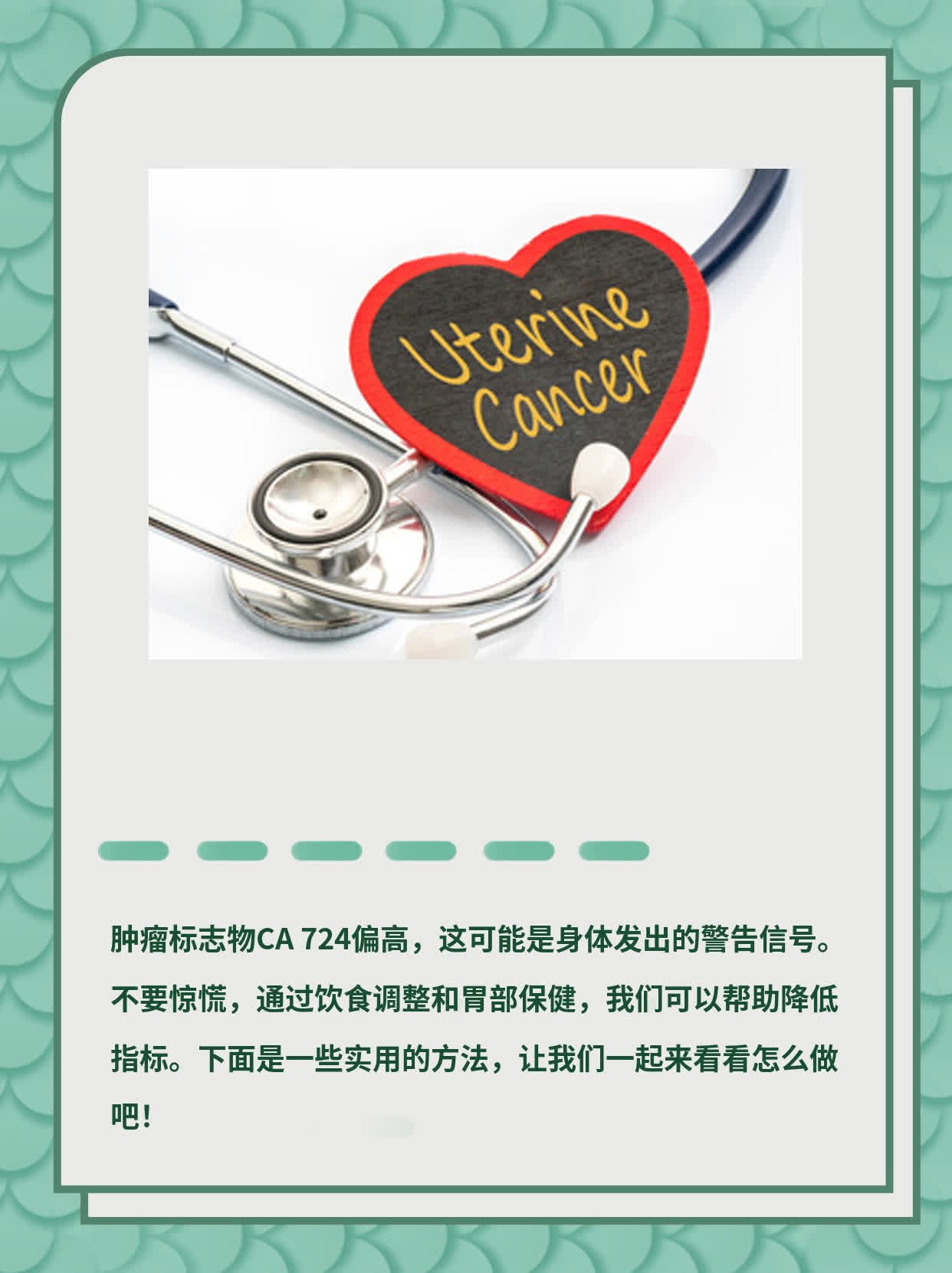 「警惕肿瘤」：CA 724 糖类抗原偏高的真相！