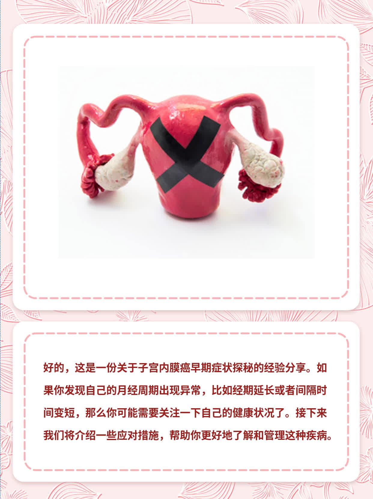 「经验分享」子宫内膜癌早期症状探秘