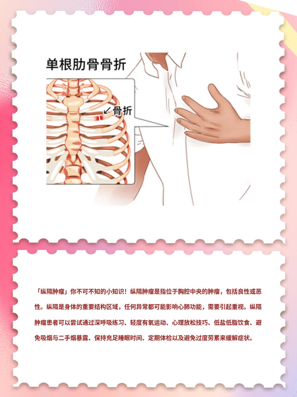 「纵隔肿瘤」你不可不知的小知识！