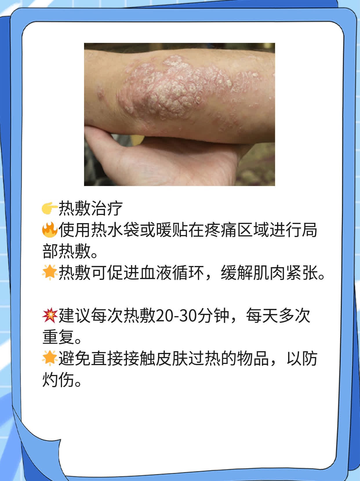 左侧肋骨痛是否为癌？探秘早期信号！
