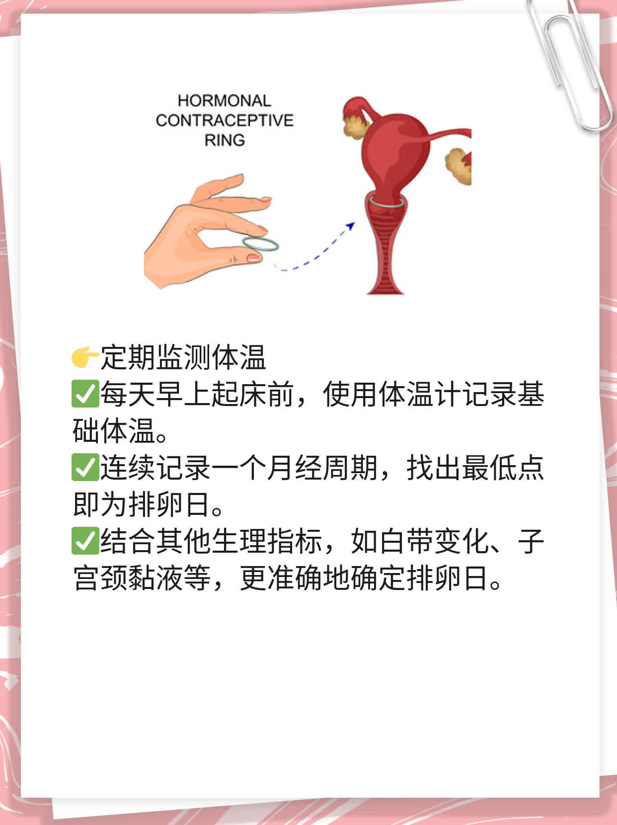 排卵期出血后发现怀孕，靠谱吗？