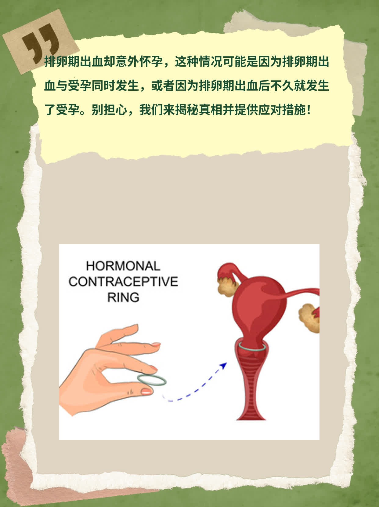 排卵期出血却意外怀孕，真相大揭秘！