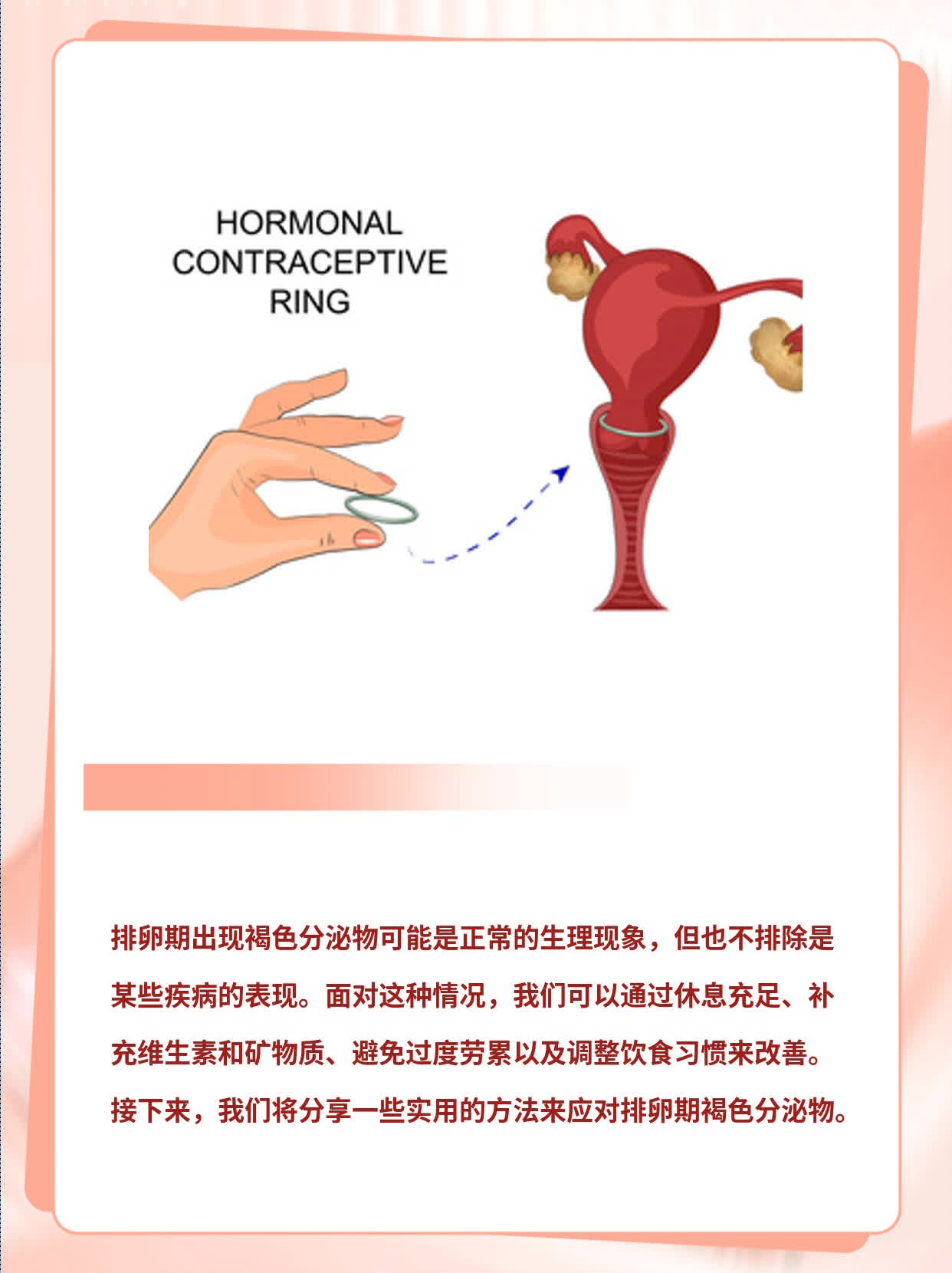 排卵期褐色分泌物——真相大揭秘！