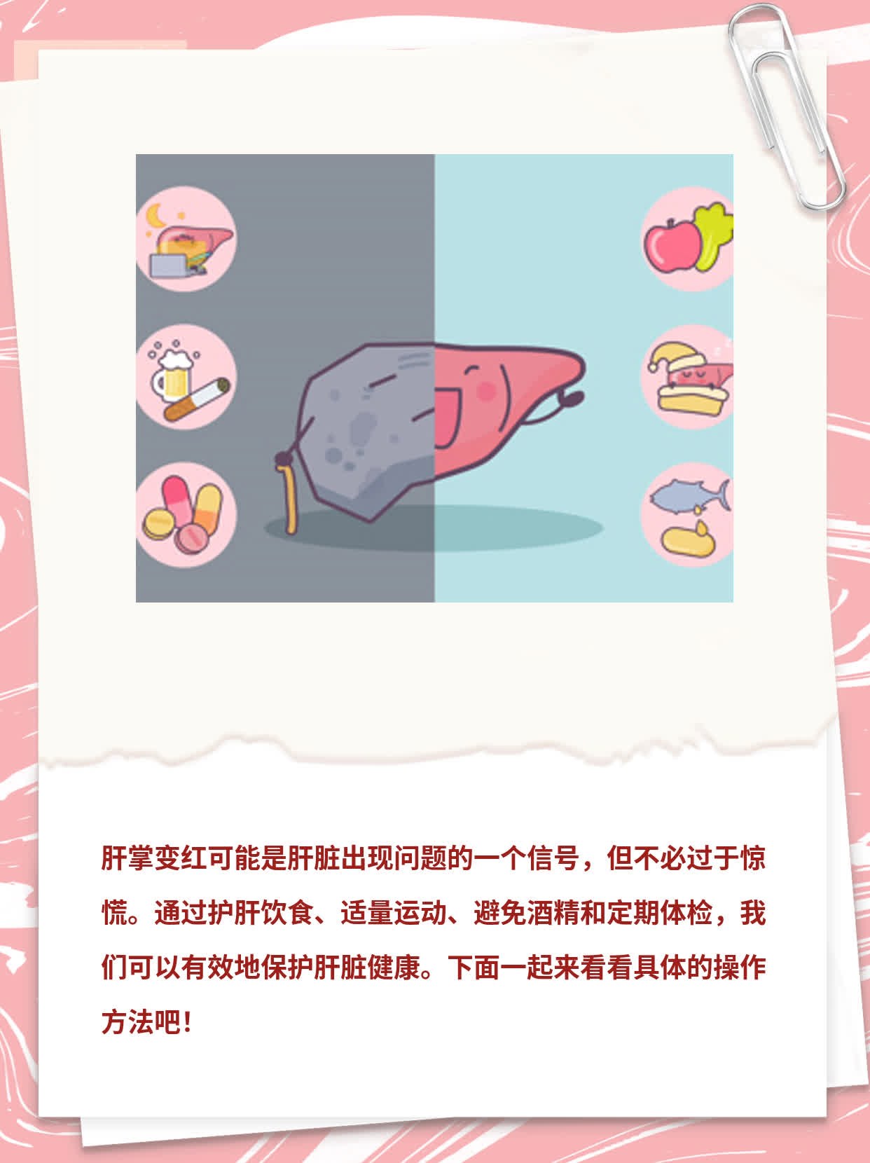 「关注」肝掌变红？警惕肝脏问题！