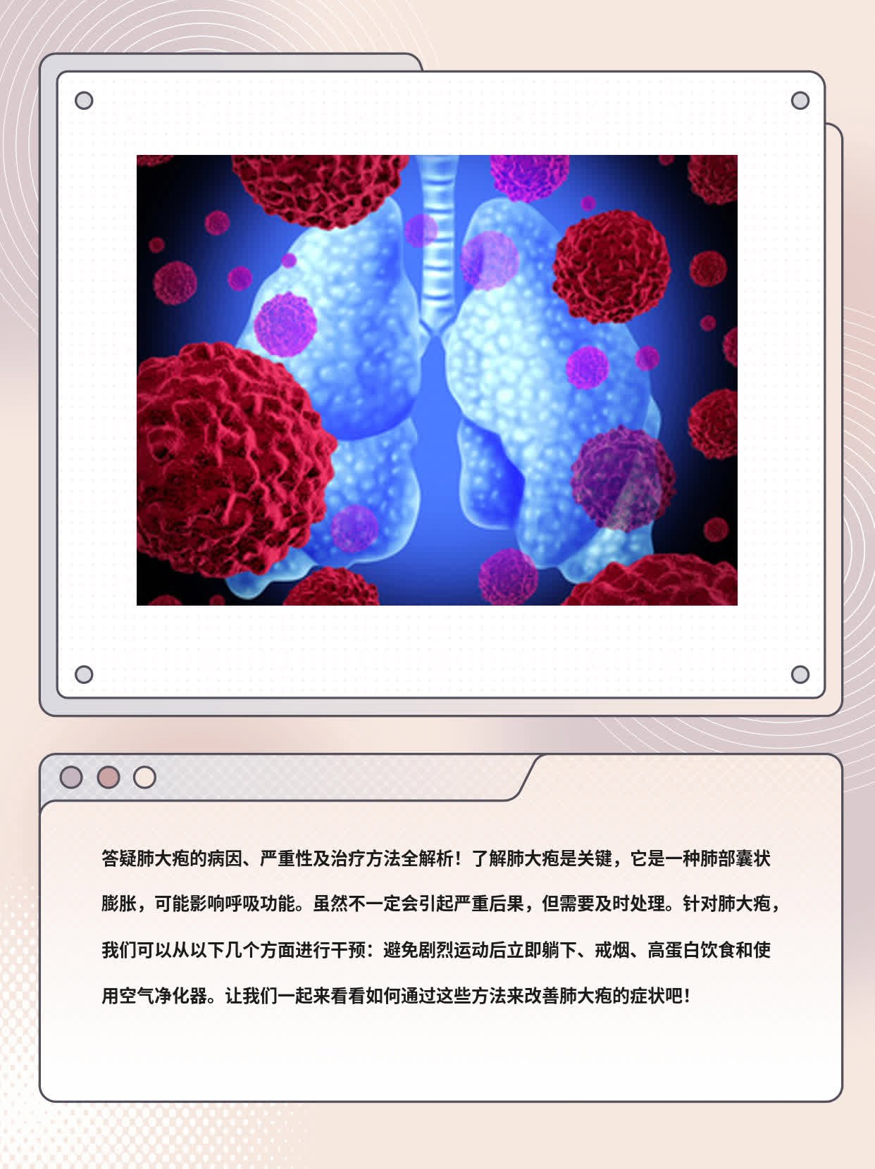 「答疑」肺大疱的病因、严重性及治疗方法全解析