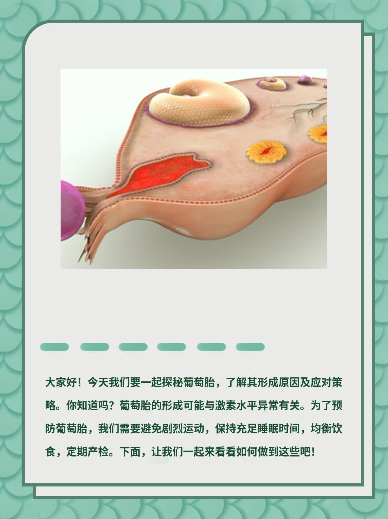 探秘葡萄胎：揭秘形成原因及应对策略