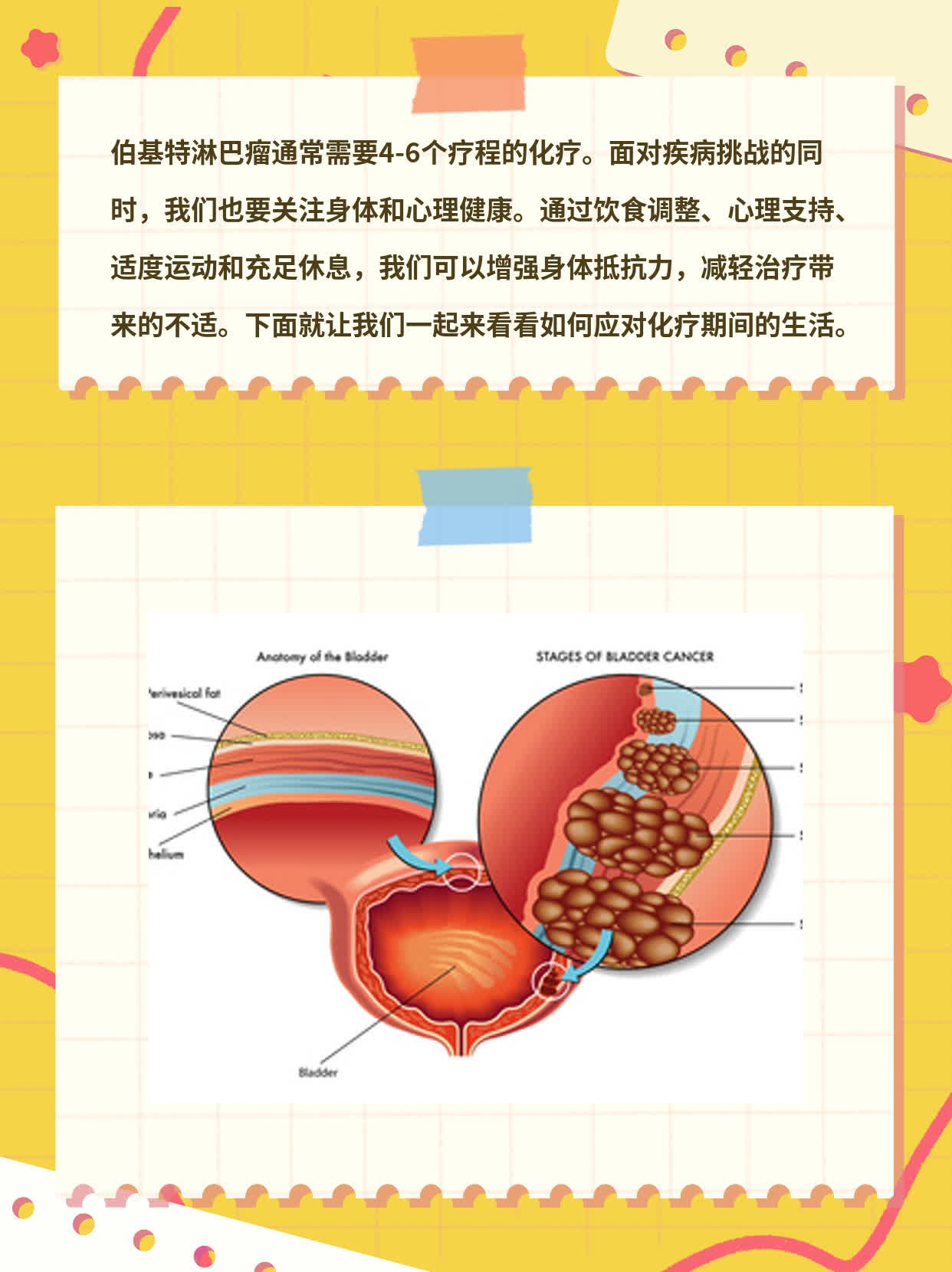 「伯基特淋巴瘤」化疗疗程数分享