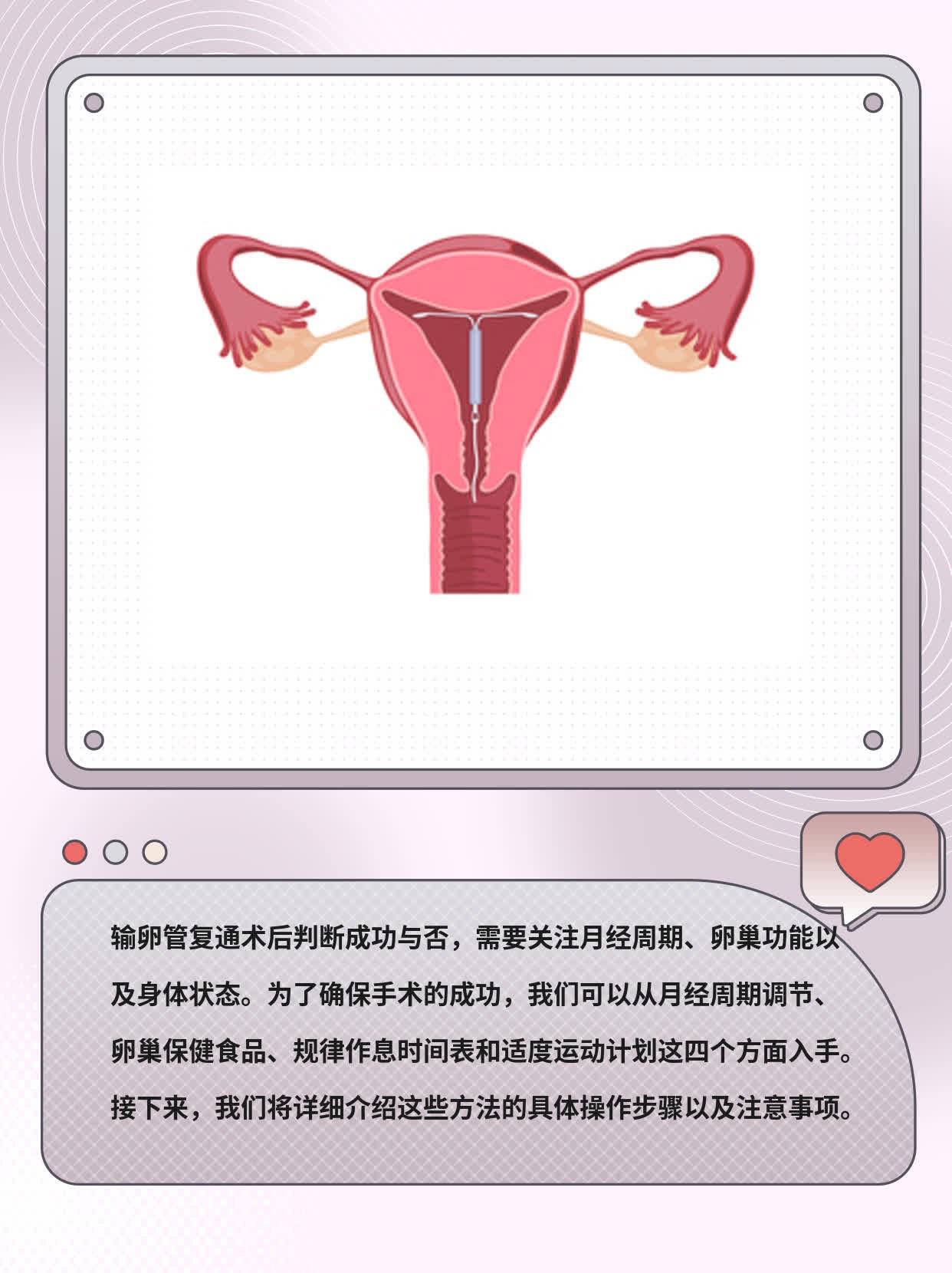 输卵管复通术后如何判断是否成功？