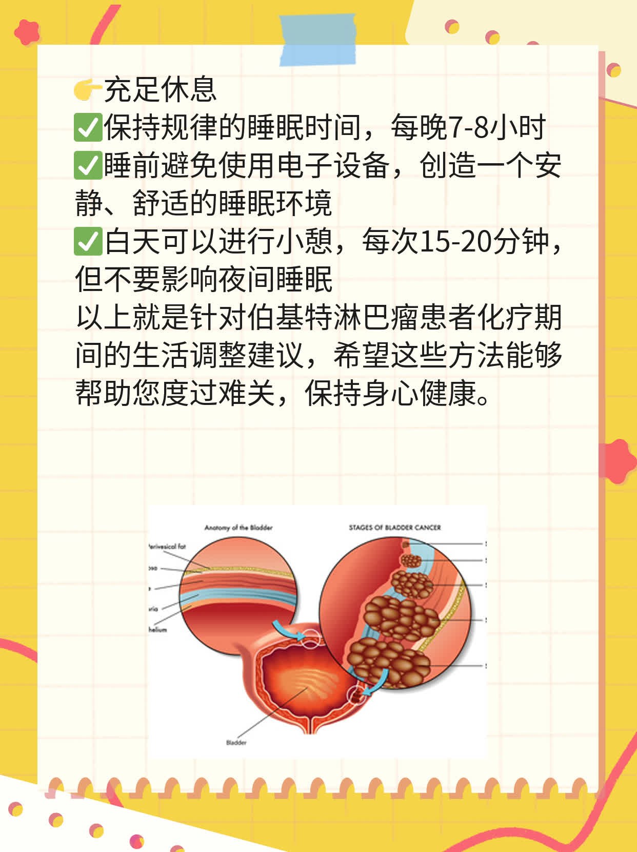 「伯基特淋巴瘤」化疗疗程数分享