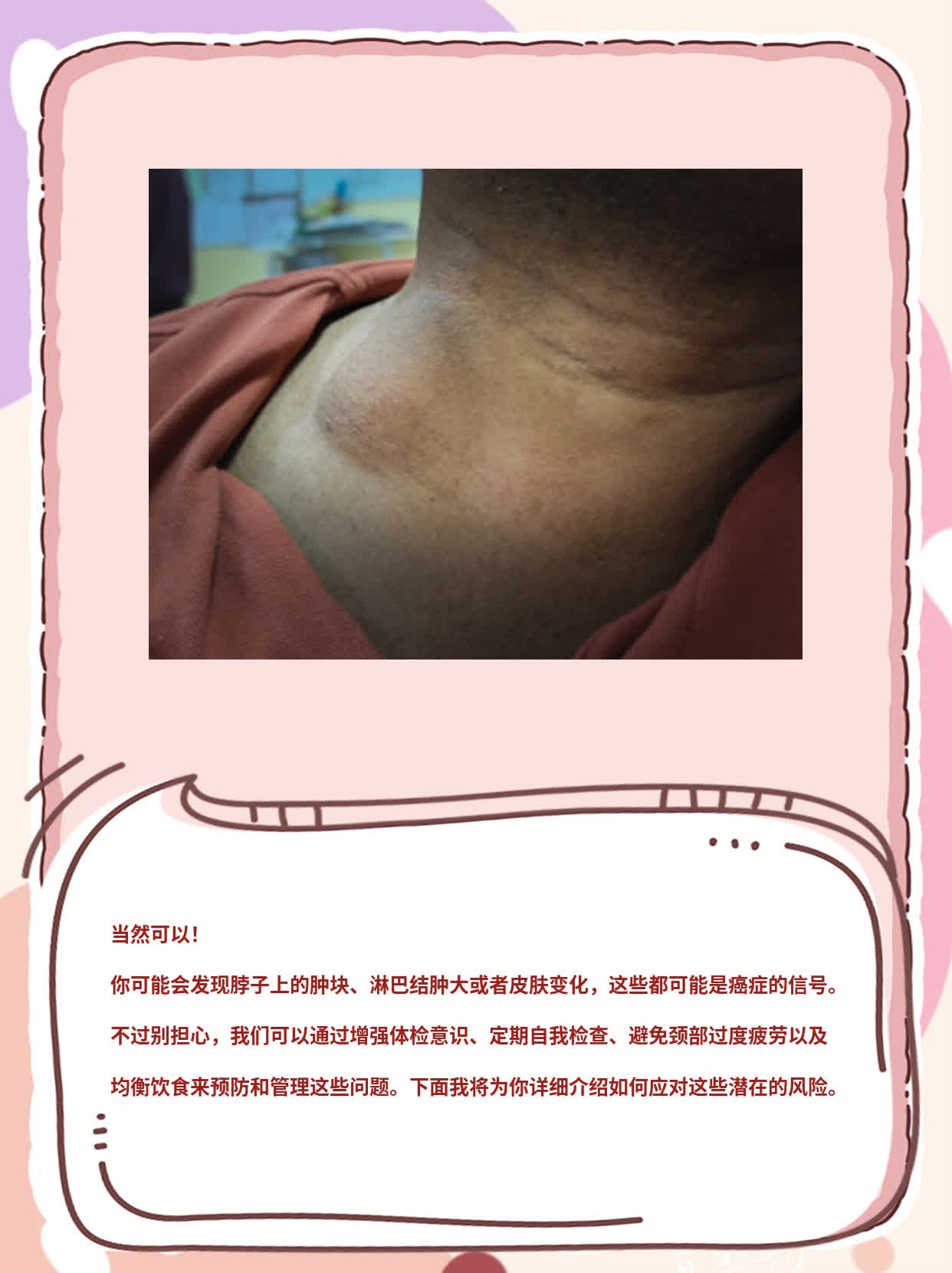 脖子上的这三个信号可能暗示着癌症！