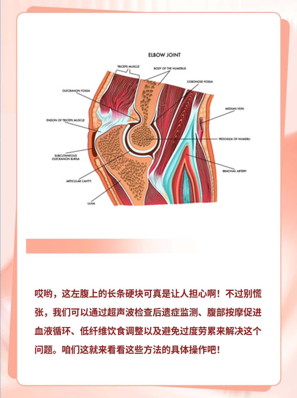 解密左侧腹部长条硬块之谜！