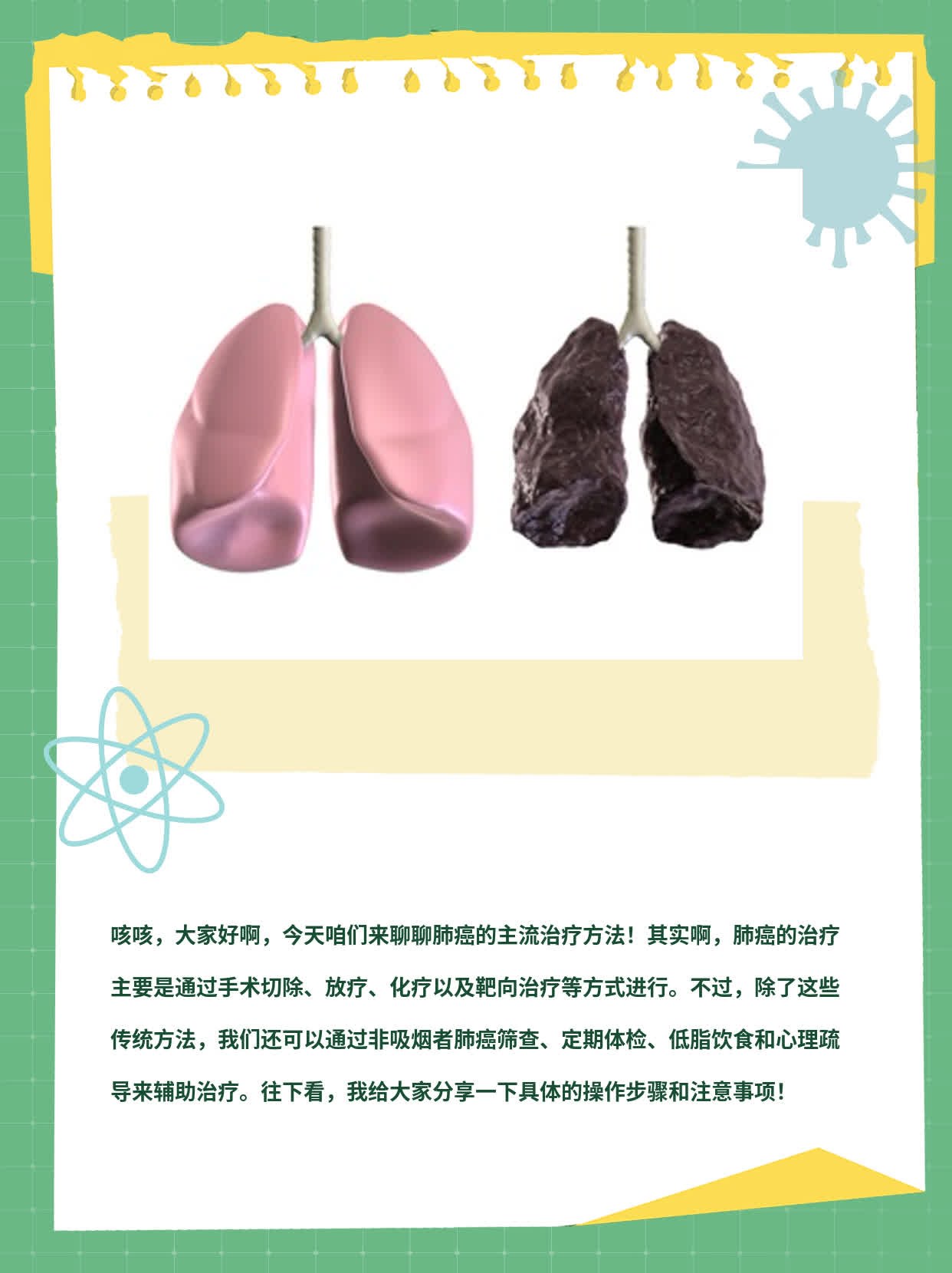 「肺癌治疗」揭秘主流方案！
