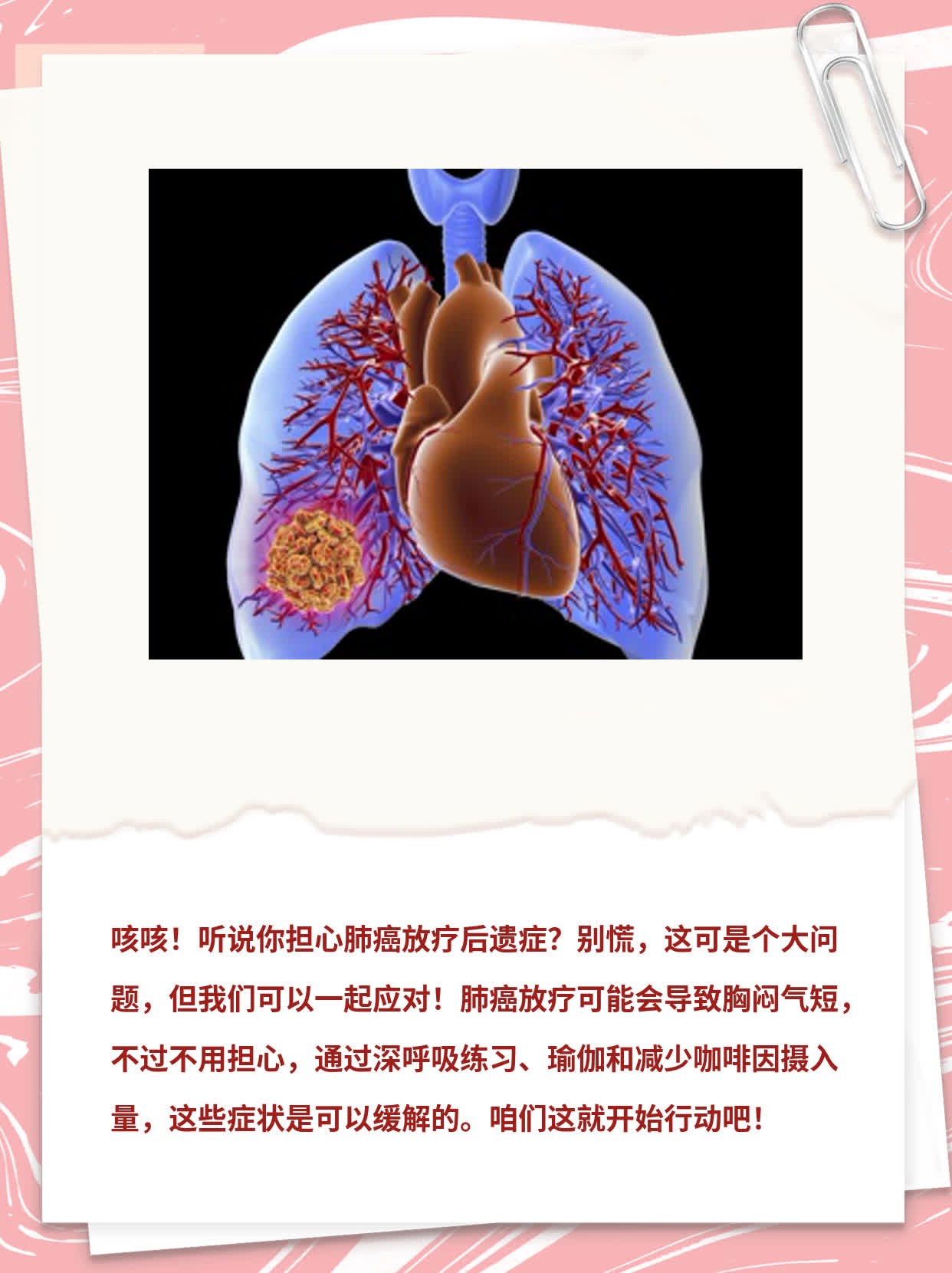 「肺癌放疗副作用」：身体受伤后的遗留问题探析