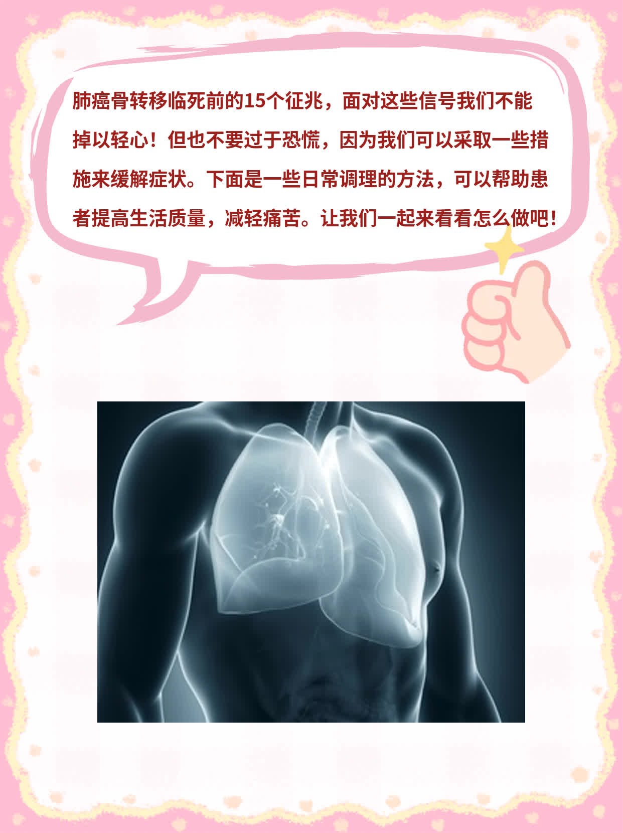 # 肺癌骨转末期征兆：这15个信号不能忽视！