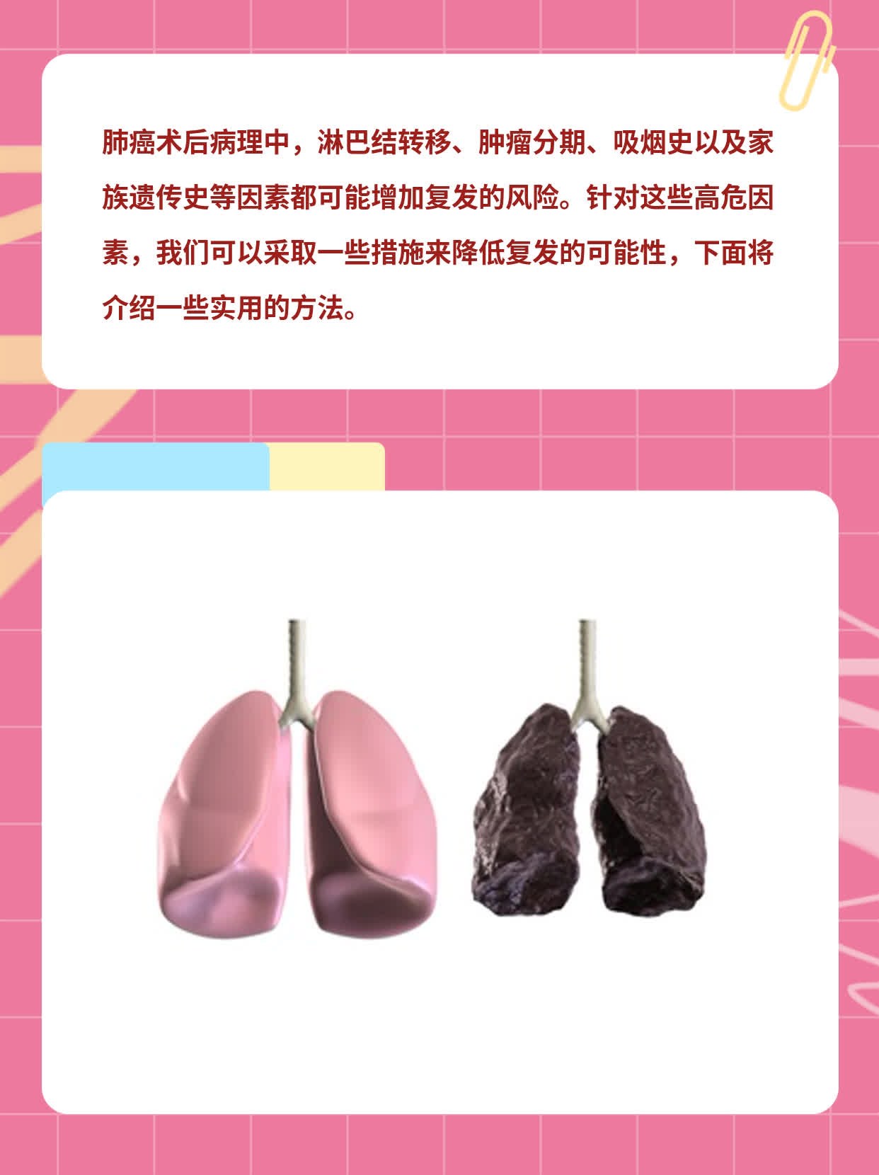肺癌术后复发高危因素分享：不容忽视的信号！