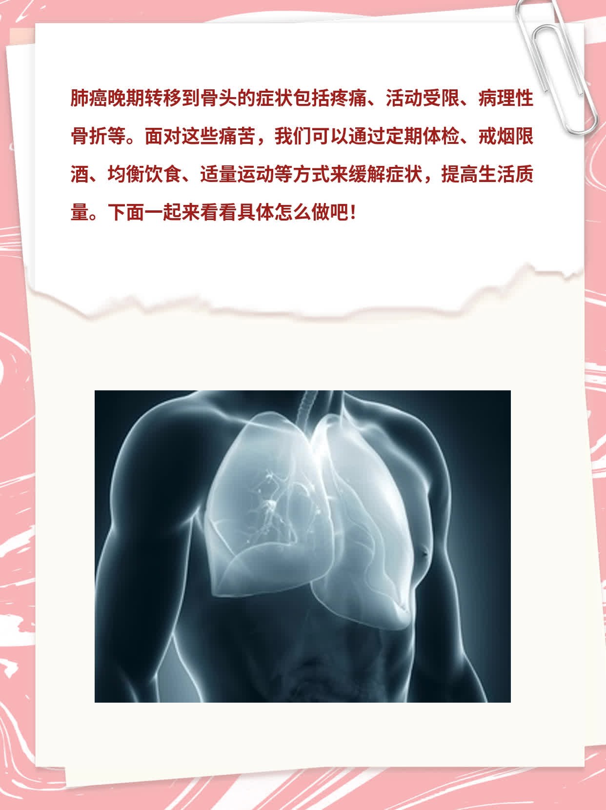 肺癌骨转移症状大盘点：晚期痛苦揭秘！