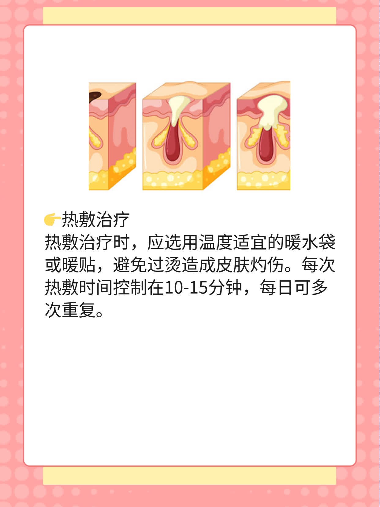 孕期初期腹痛：原因探析及缓解方法