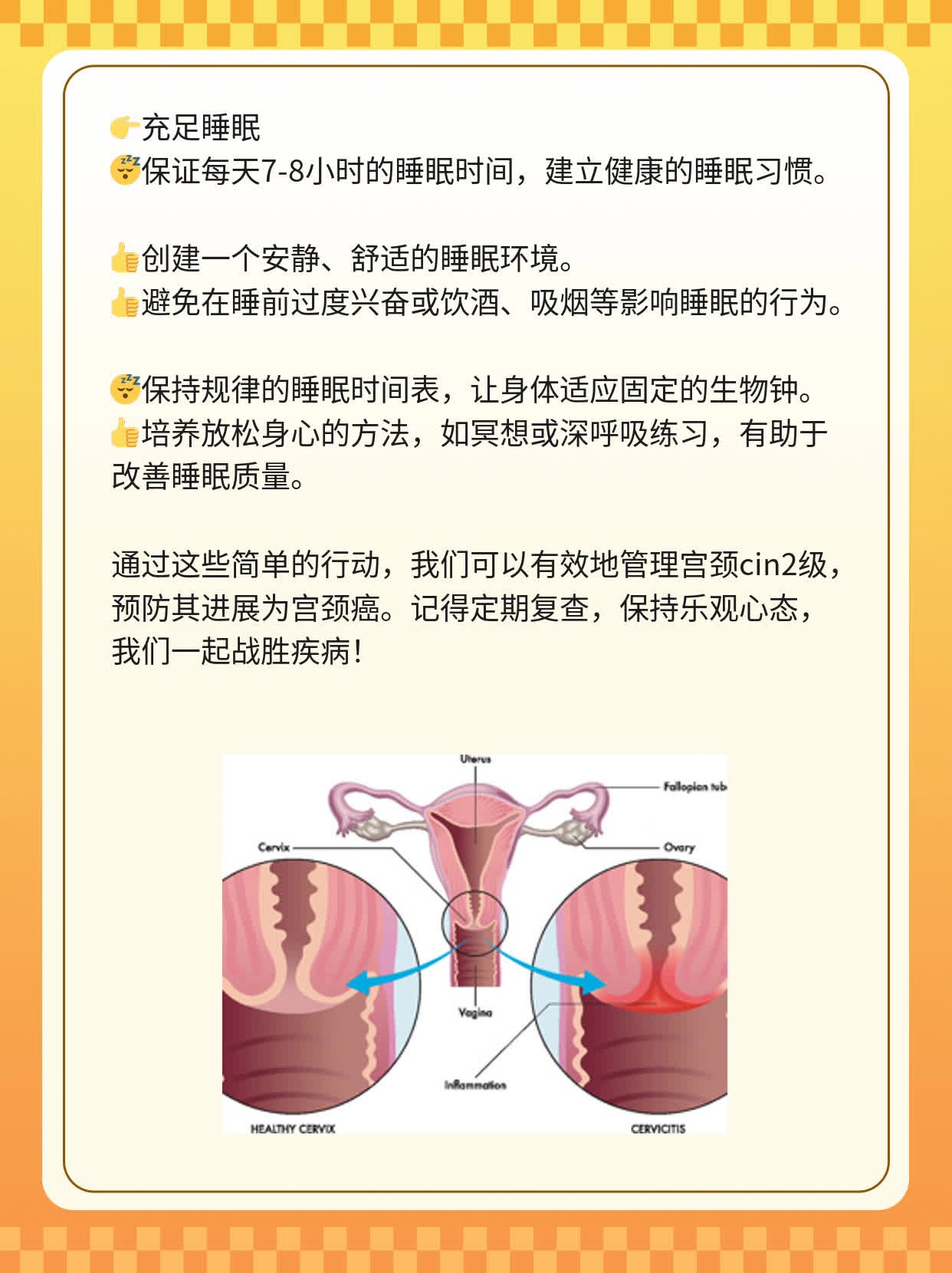 宫颈cin2级——癌变前的警报！