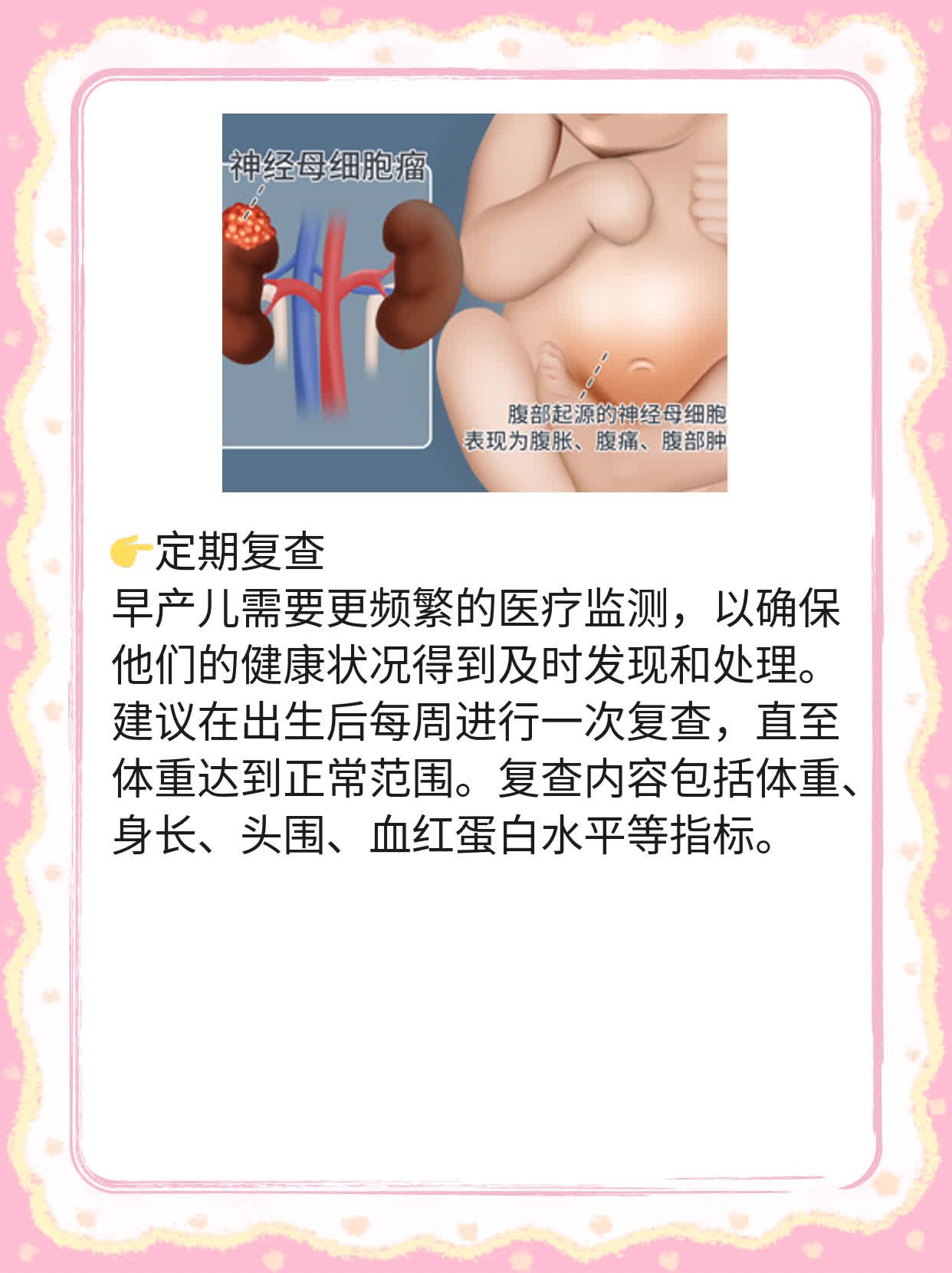 揭秘：早产儿出生时体重低于多少才算低？
