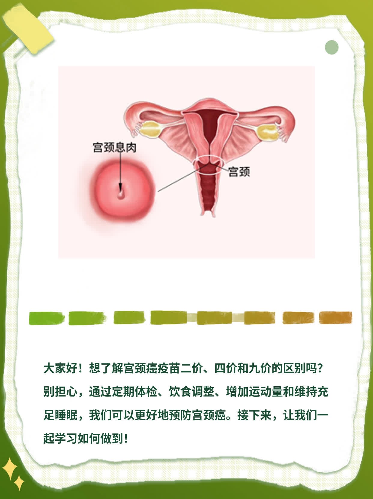 宫颈癌疫苗：二价、四价和九价有何不同？