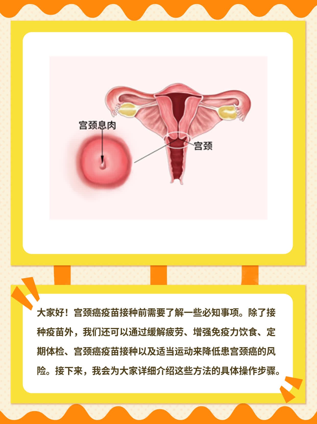 宫颈癌疫苗接种必知事项分享