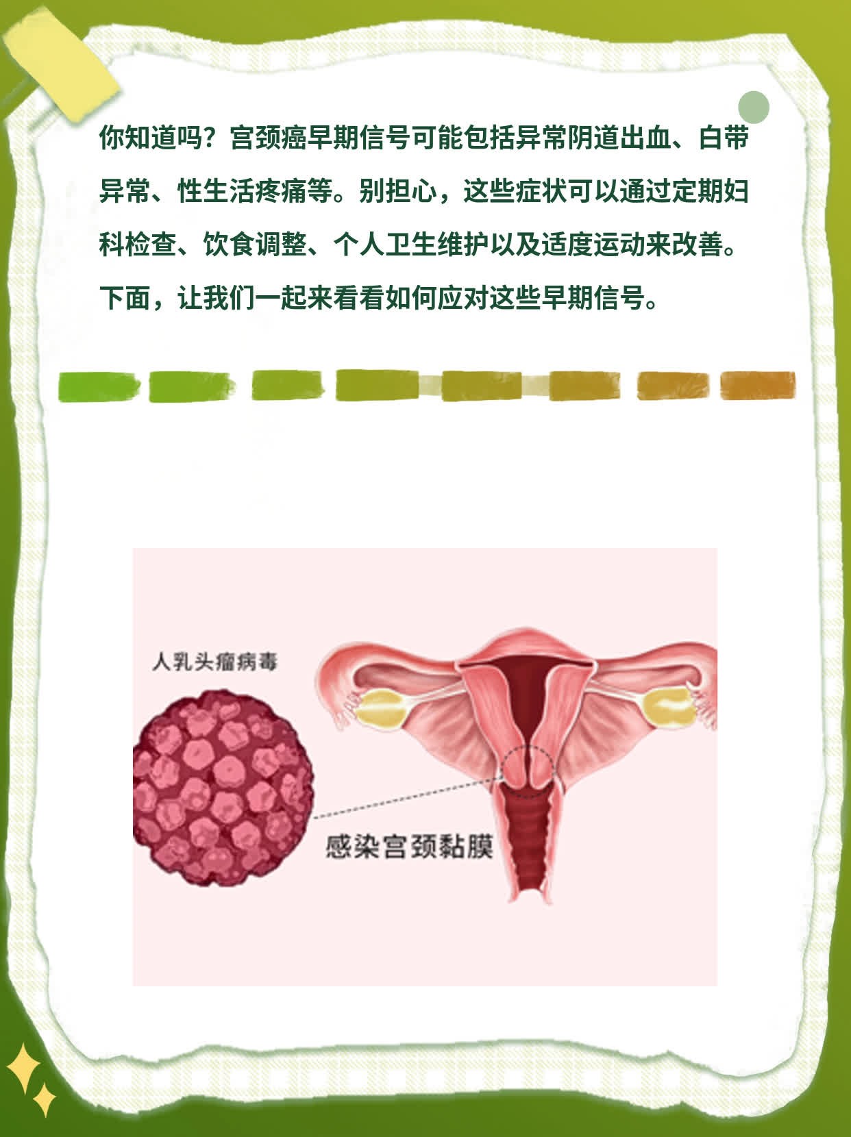 「宫颈癌早期信号」你知道吗？