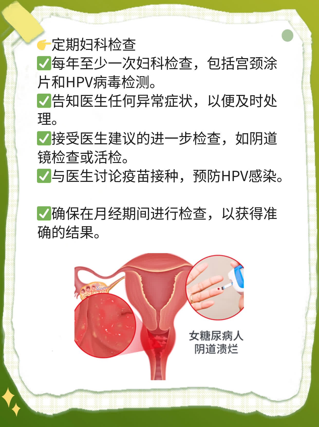 「宫颈癌早期信号」你知道吗？