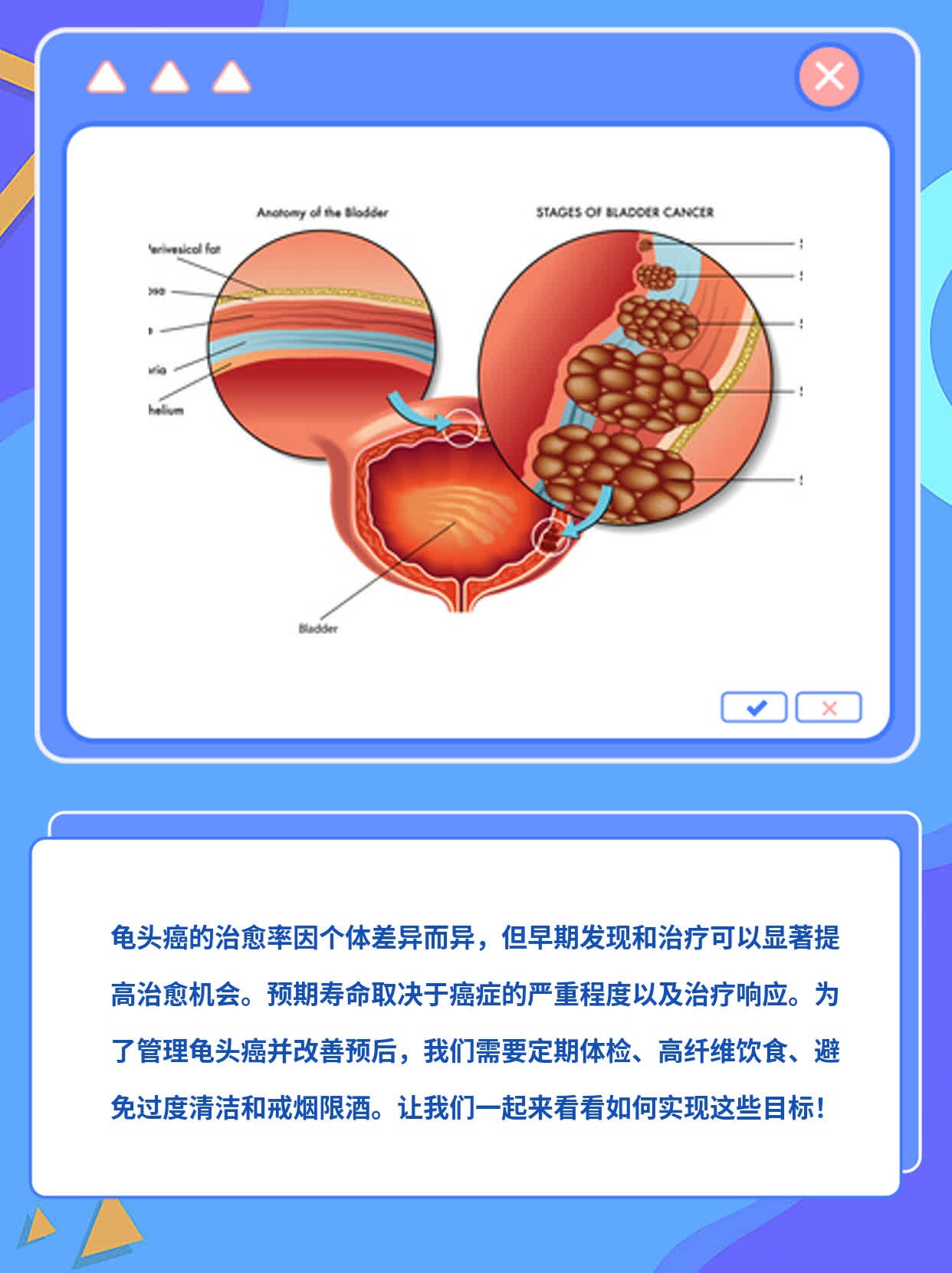 龟头癌可否治愈及预期寿命
