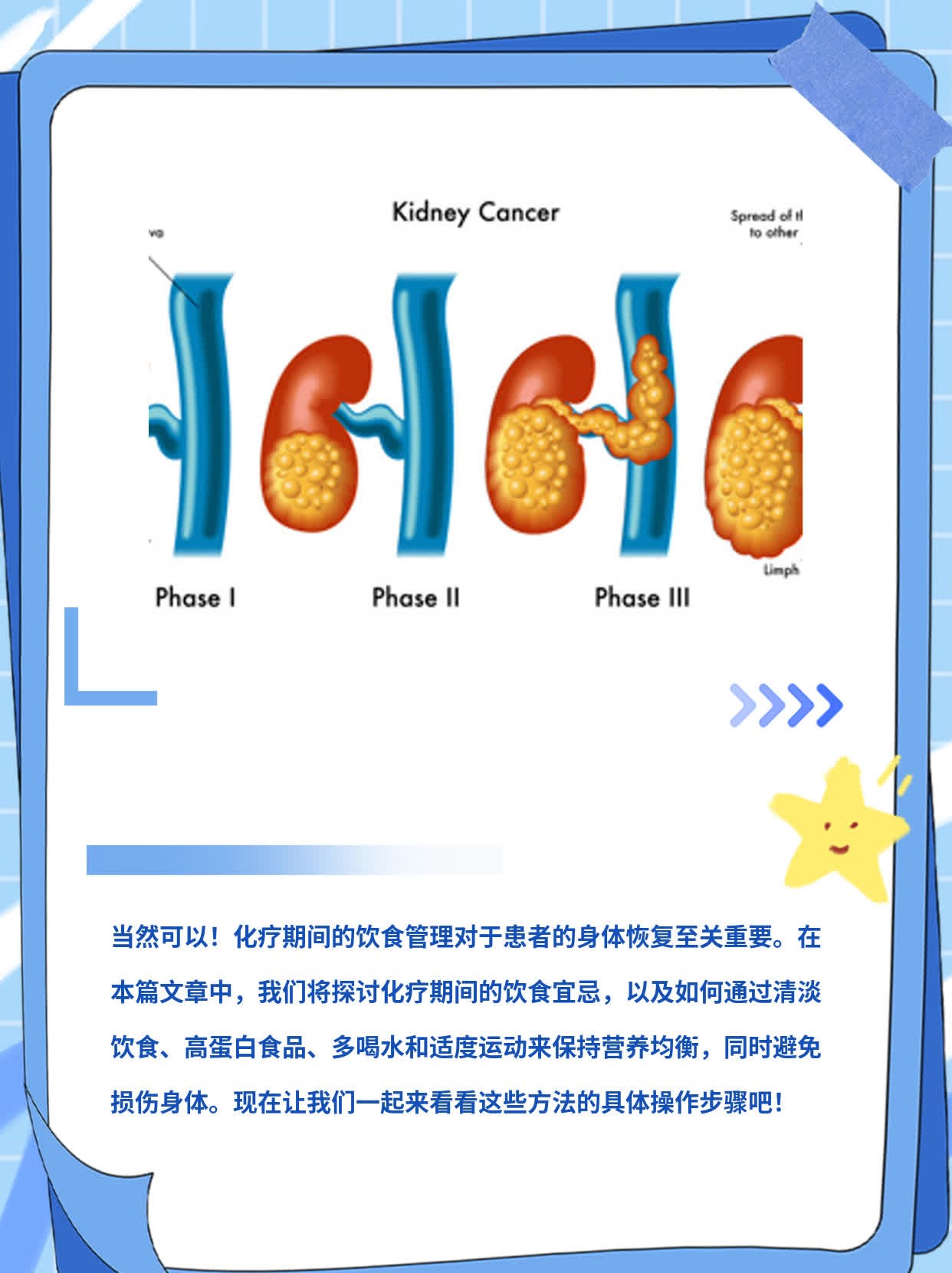 化疗期间饮食宜忌：营养又不伤身！