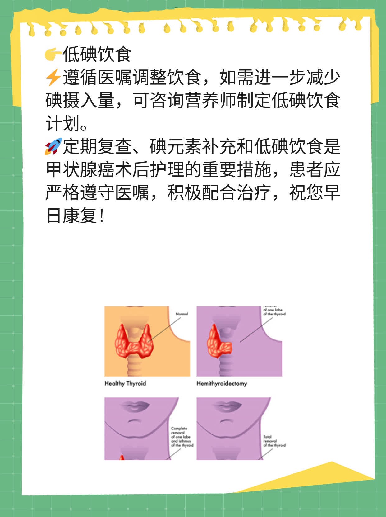 术后护理指南：甲状腺癌患者必知事项