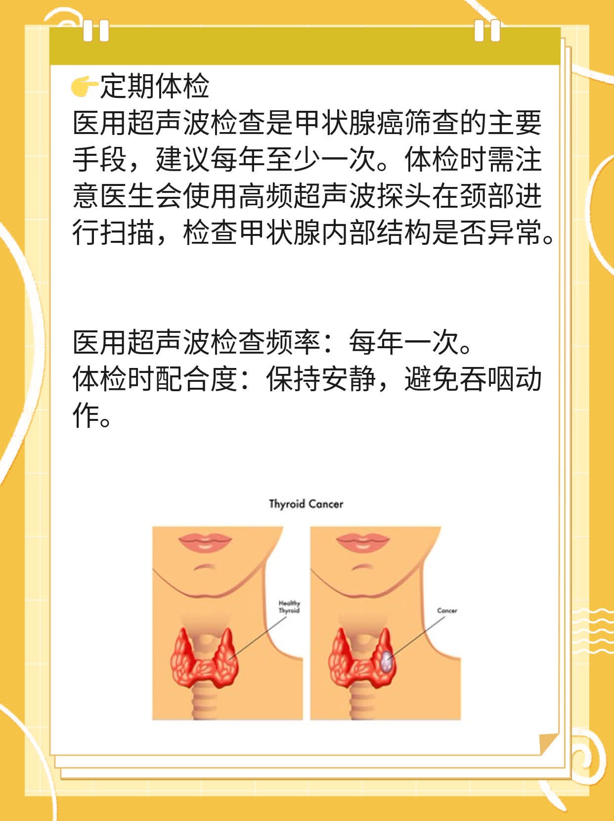 「经验分享」甲状腺癌分期：早期VS晚期判断全攻略