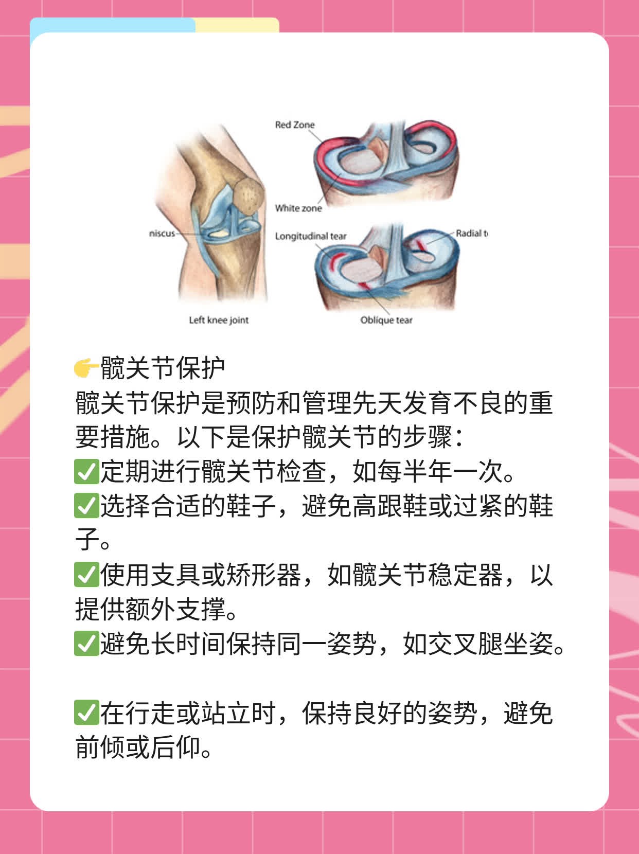 「经验分享」髋关节先天发育不良的治疗妙招
