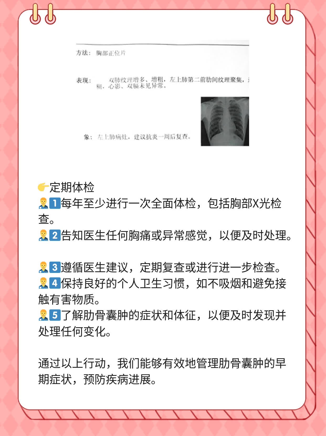 肋骨囊肿初期征象图解