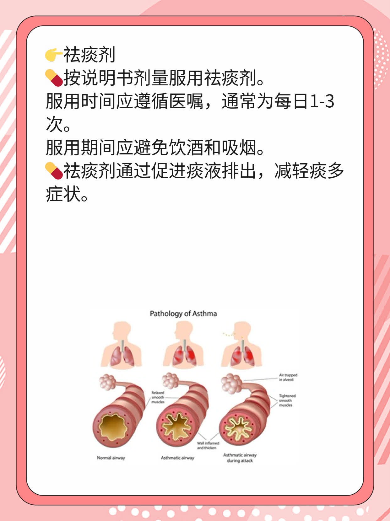 「咳嗽有痰」妙招：搞定黏在喉咙里的痰！