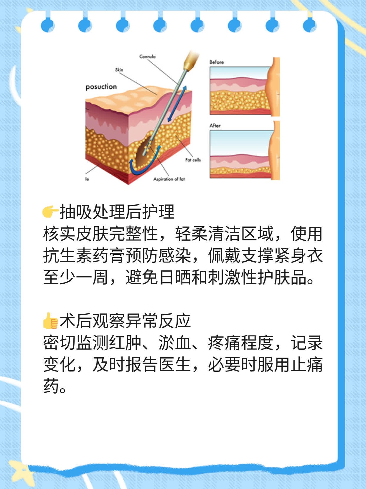 揭秘：自体脂肪垫下巴的缺陷大揭秘！