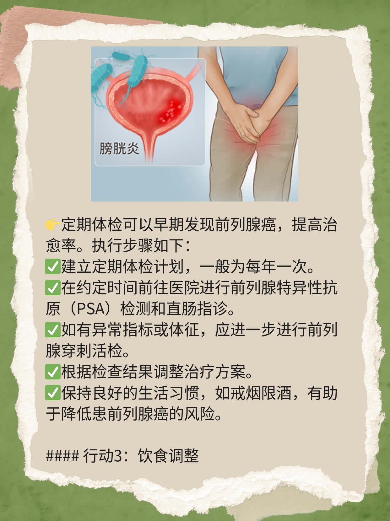 「前列腺癌治疗」经验分享：探索有效方法！