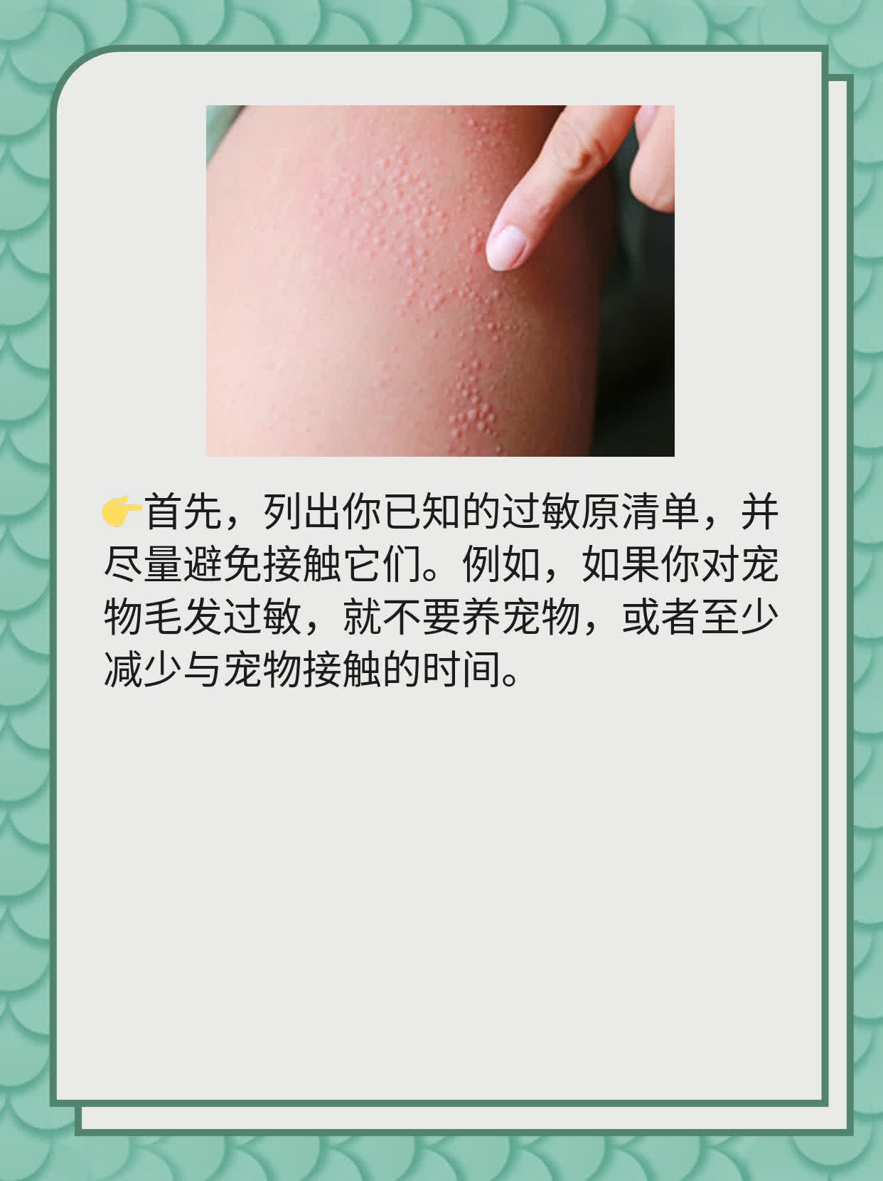 「喷嚏连连 鼻子不爽」：止住不停打喷嚏和流鼻涕的妙招！