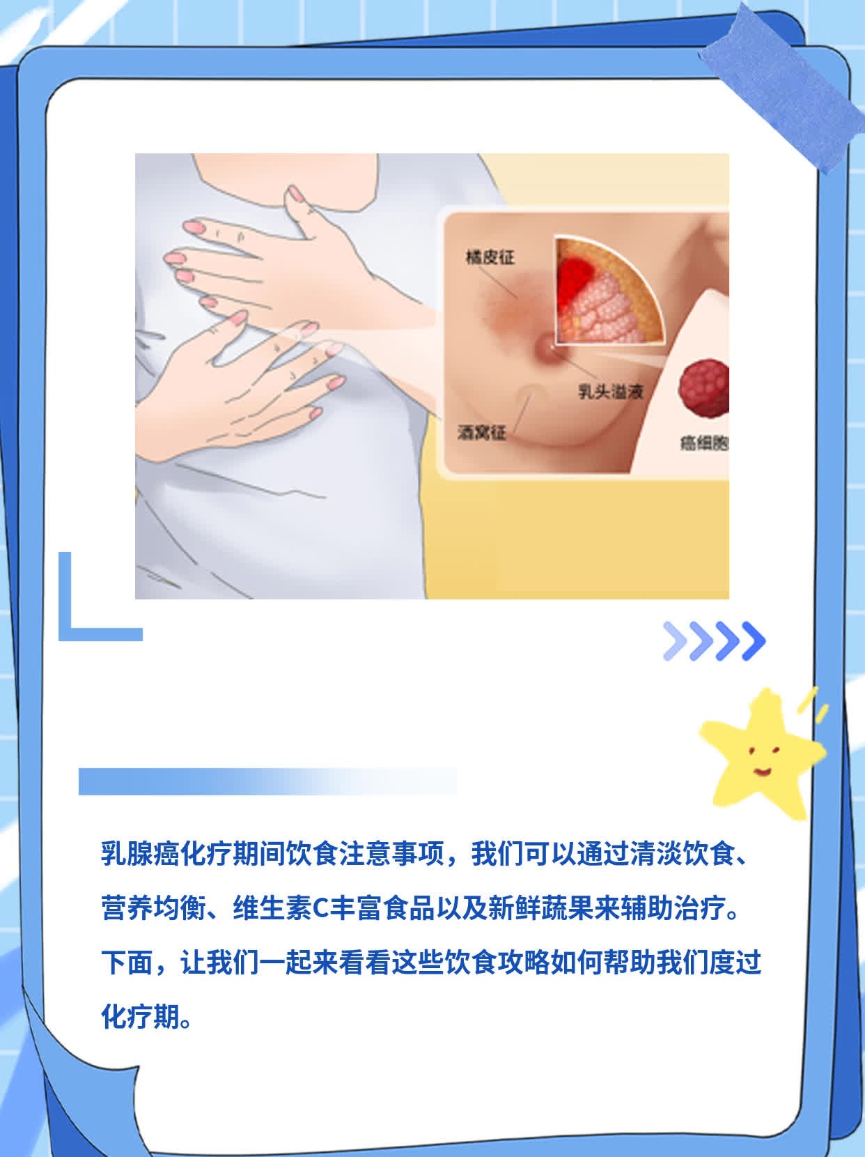 「化疗期饮食攻略」：乳腺癌患者必看！