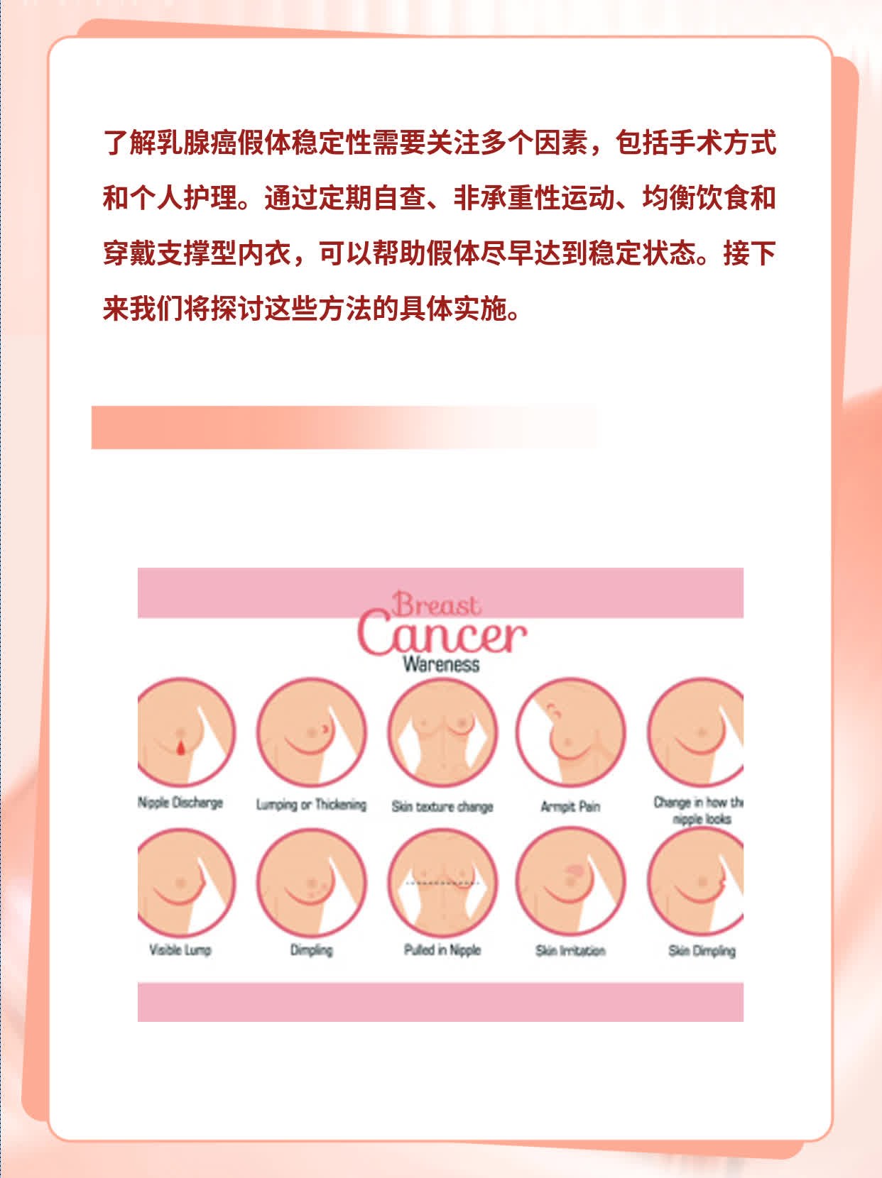 探讨乳腺癌假体稳定性：从手术到稳定的时长